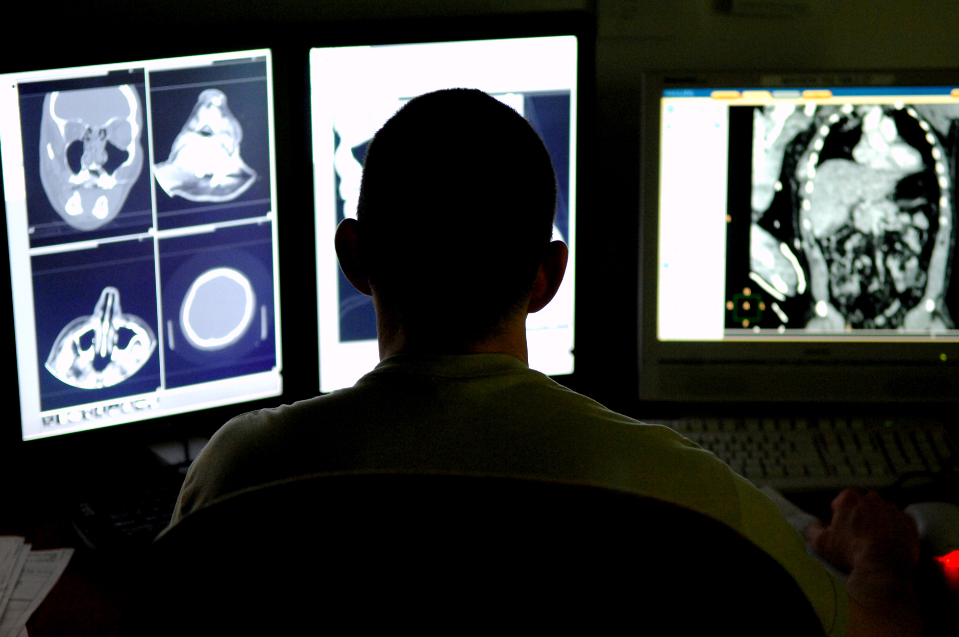 Maj. Michael Matchette, 332nd Expeditionary Medical Support Squadron radiologist, reviews computed tomography scans from a trauma patient to determine the severity of the injuries at the Air Force Theater Hospital, Feb. 20. The CT scan process goes directly from the scanning machine to the computer, which allows doctors to diagnose medical problems faster. Matchette is deployed from Lackland Air Force Base, Texas.